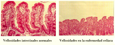 Vellosidades Intestinal